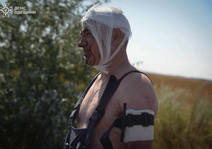 Один із постраждалих внаслідок російських атак