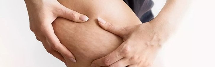 Не фастфудом единым: названы продукты, провоцирующие целлюлит