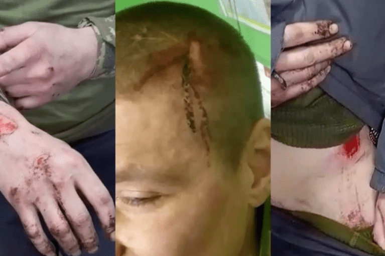 Журналисты установили 26 смертей среди мобилизованных новобранцев "Скалы", начиная с осени 2025 года
