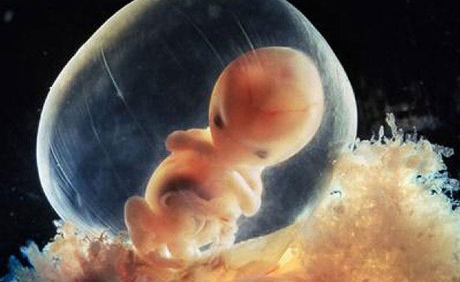 8 недель беременности вторая беременность. Леннарт Нильсон Зарождение жизни. Эмбрион Леннарт Нильсон.