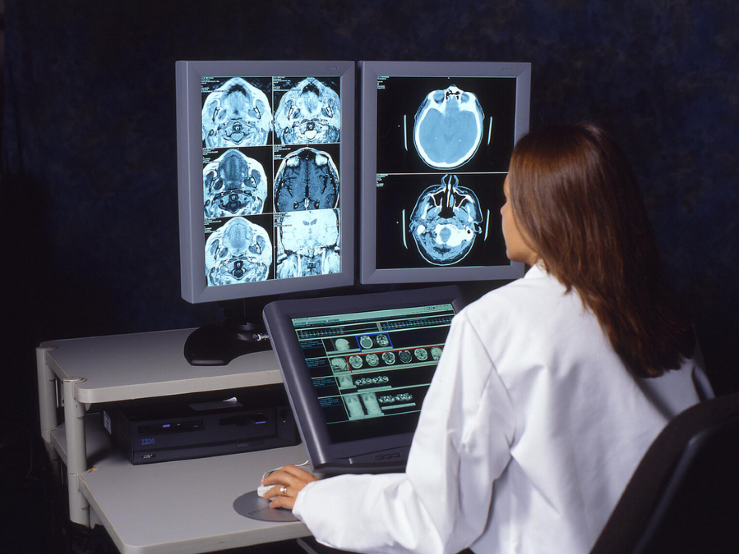 Диагностировать патологию. Томография. Исследование мозга. Методы исследования мозга человека. Изучение мрт головного мозга.