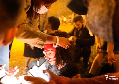 Під час протестів у Мінську були поранені мітингувальники. Фото: Радіо Свобода