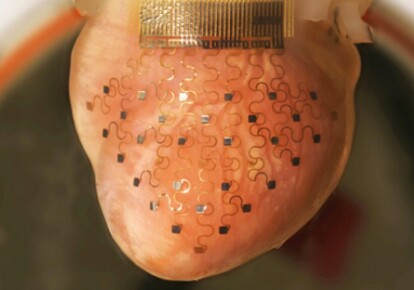 Новый 3D имплантат обеспечит вечную работу сердца