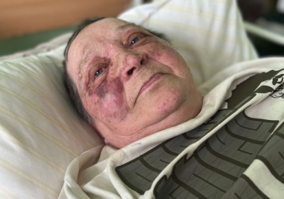 75-летняя Татьяна Антонюк в больнице Святого Луки
