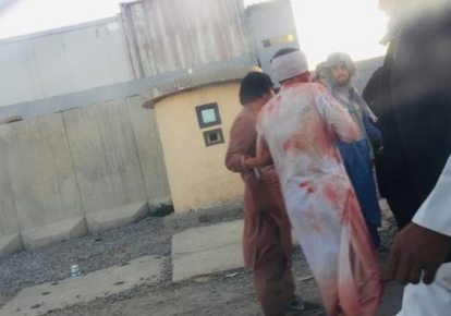 Пострадавший в результате теракта в Кабуле