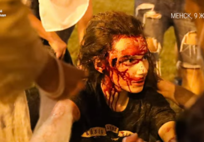 Побита силовиками протестувальниця у Мінську