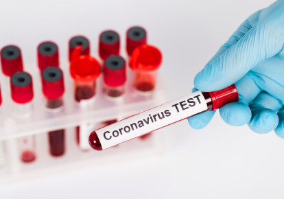 Эпидемия коронавируса в Украине пока не идет на спад