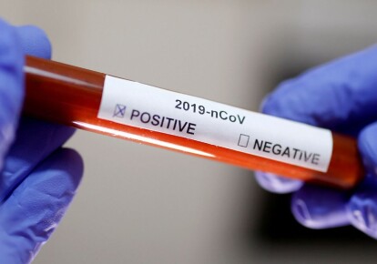 Понад 10 тисяч нових випадків зараження коронавірусом;