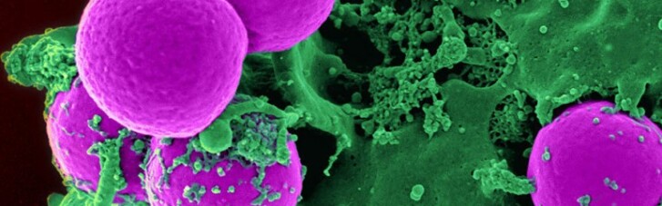 Шанс выжить: ученые придумали как бороться с устойчивостью к антибиотикам