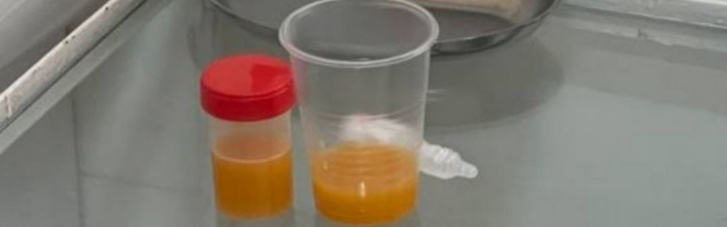 Во Львове водитель в состоянии наркотического опьянения сдал на анализ мочи мультифруктовый сок (ФОТО)