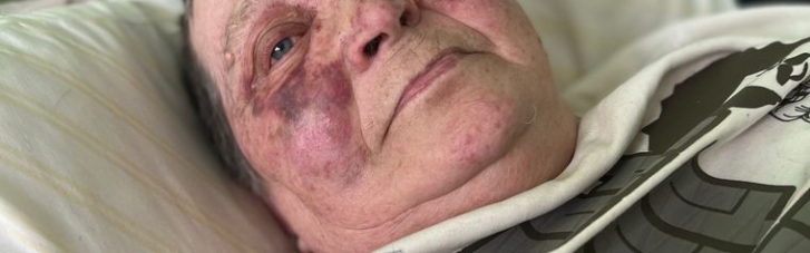 У Херсоні рашисти зламали хребет 75-річній жінці-волонтеру, яка не хотіла віддавати український паспорт