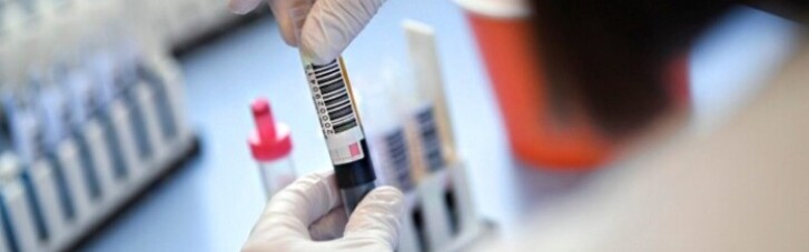 Не коронавірус: Експерти попередили про загрозу нової масштабної пандемії