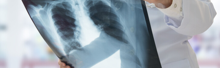 20 питань про туберкульоз: чи передається хвороба через поцілунки і треба робити БЦЖ