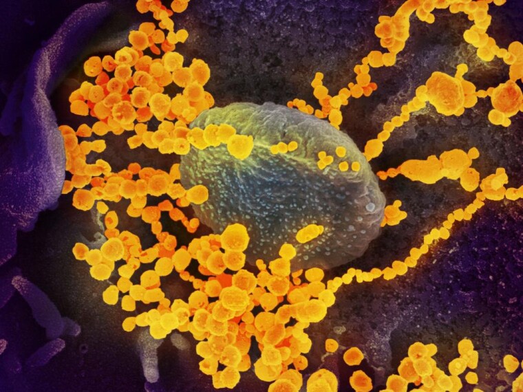 Зображення SARS-CoV-2, коронавірусу, що викликає Covid-19, на скануючому електронному мікроскопі/NIAID/flickr)