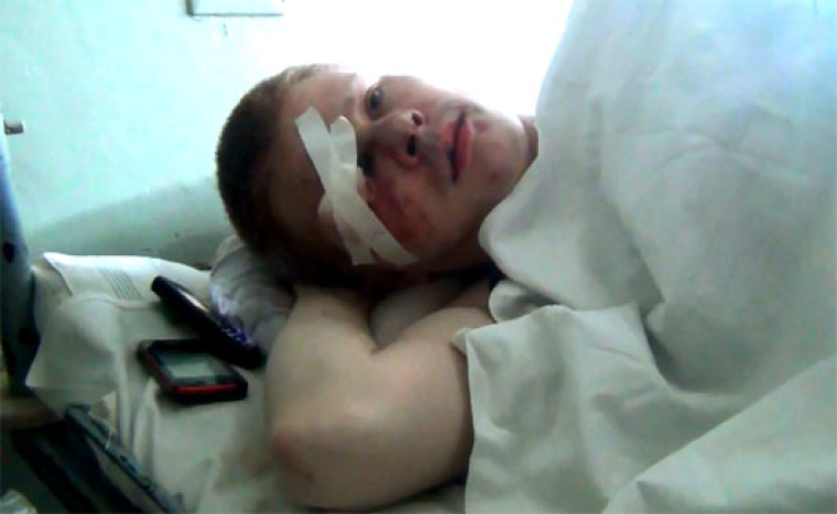 Ростислав Шапошніков в лікарні після побиття