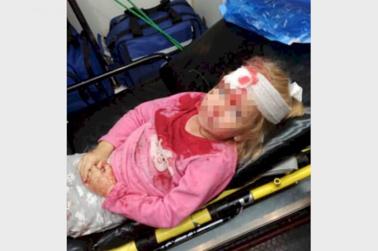 В Гродно броированный джим силовиков протаранил авто с 5-летней девочкой