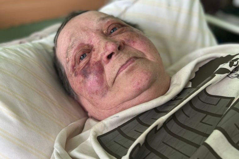 В Херсоне рашисты сломали позвоночник 75-летней женщине-волонтеру, которая не хотела отдавать украинский паспорт